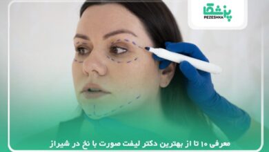معرفی 10 تا از بهترین دکتر لیفت صورت با نخ در شیراز【سال1405】❤️