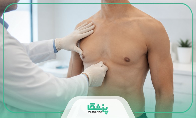 روش های پیشگیری از ژنیکوماستی در آقایان