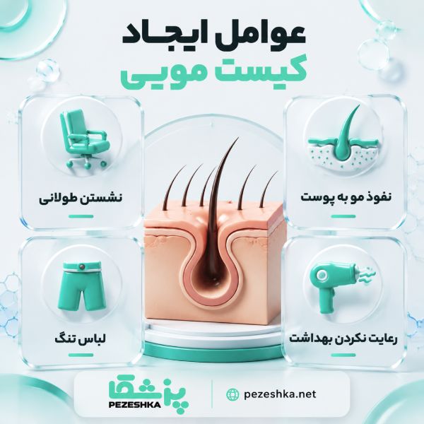 کیست مویی چیست؟