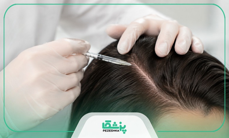 چه عواملی روی هزینه های مزوتراپی مو تاثیر می گذارد؟