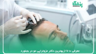 معرفی 10 تا ازبهترین دکتر مزوتراپی مو در بجنورد【سال 1405】❤️