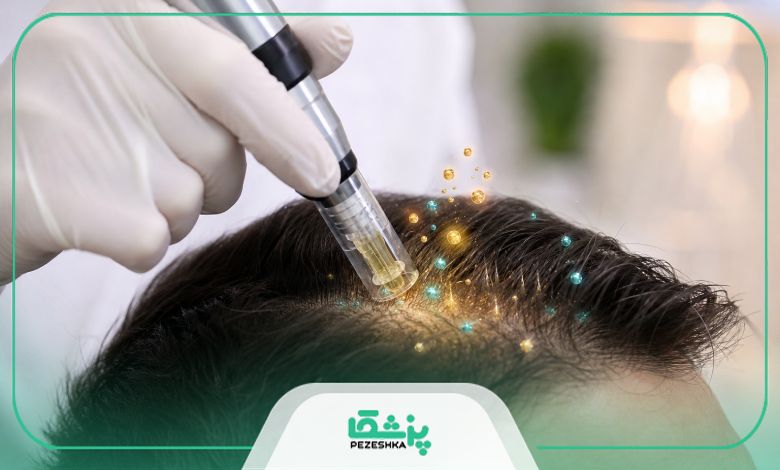 مراقبت های بعد از مزوتراپی مو