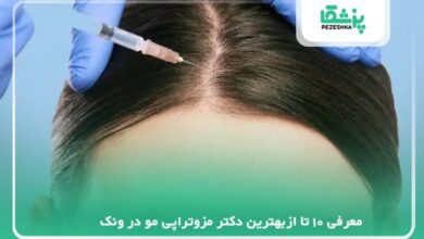 معرفی بهترین دکتر مزوتراپی مو در ونک