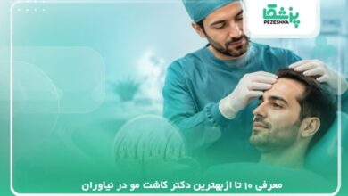 معرفی10تا ازبهترین دکتر کاشت مو در نیاوران【سال 1405】❤️