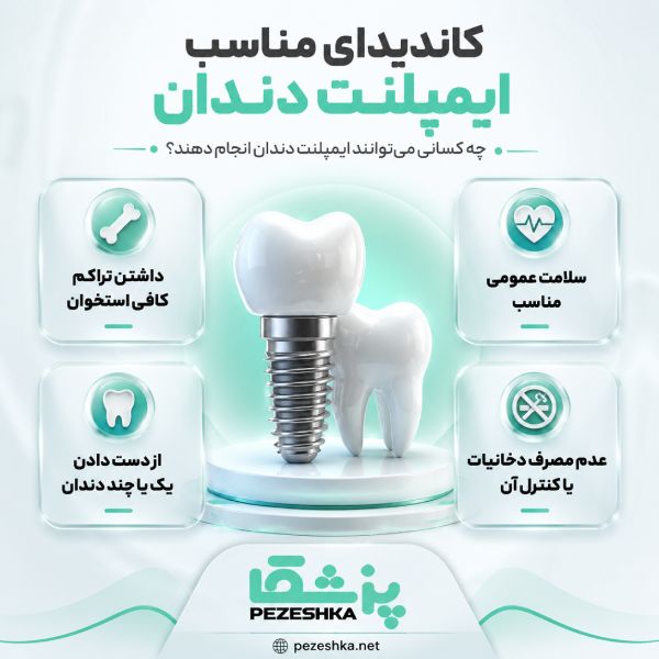 ویژگی بهترین دکتر ایمپلنت در فرشته
