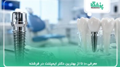 معرفی 10 تا از بهترین دکتر ایمپلنت در فرشته【سال1405】❤️