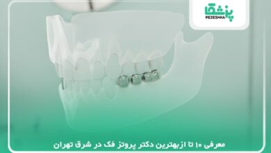 معرفی 10 تا ازبهترین دکتر پروتز فک در شرق تهران【سال1405 】❤️