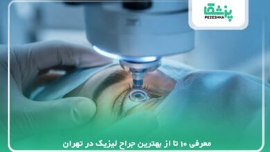 10 تا از بهترین جراح لیزیک در تهران⭐【سال1405】✅