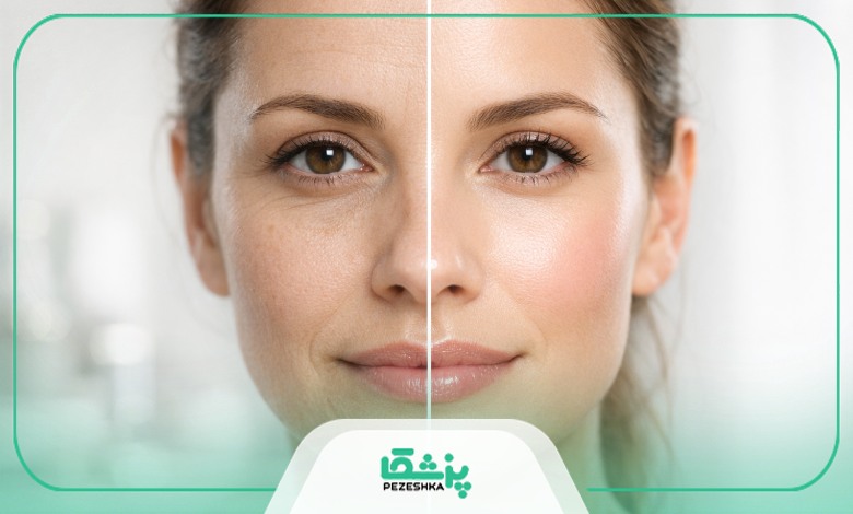 مزوتراپی چه عوارض جانبی به همراه دارد؟