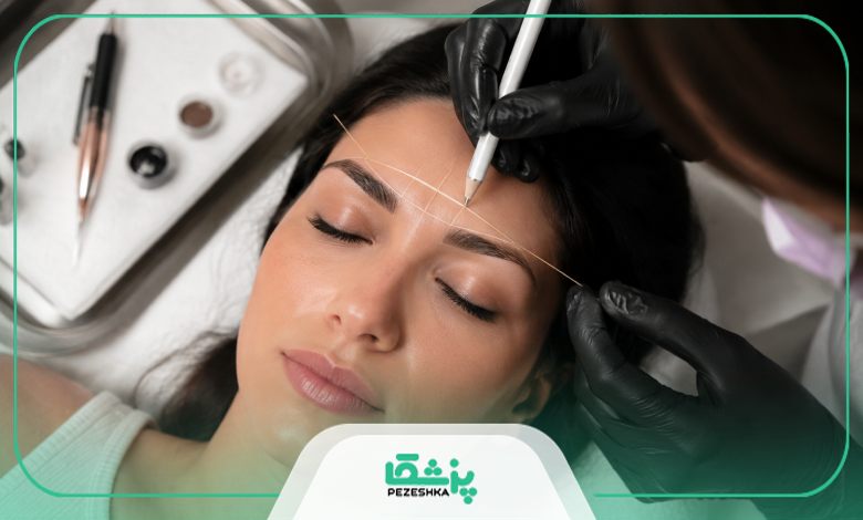 نکات مراقبتی پس از میکروبلیدینگ