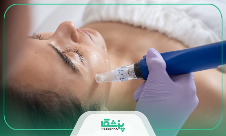 نکات مراقبتی پس از میکرونیدلینگ