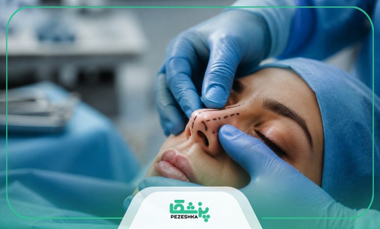 روش های جراحی بینی