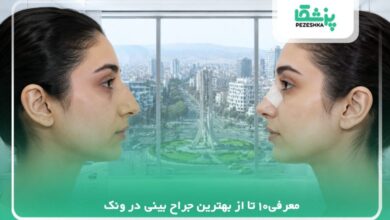معرفی10 تا از بهترین جراح بینی در ونک✅【سال 1405】⭐