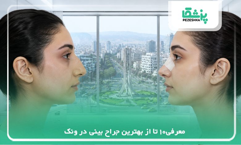 معرفی10 تا از بهترین جراح بینی در ونک✅【سال 1405】⭐
