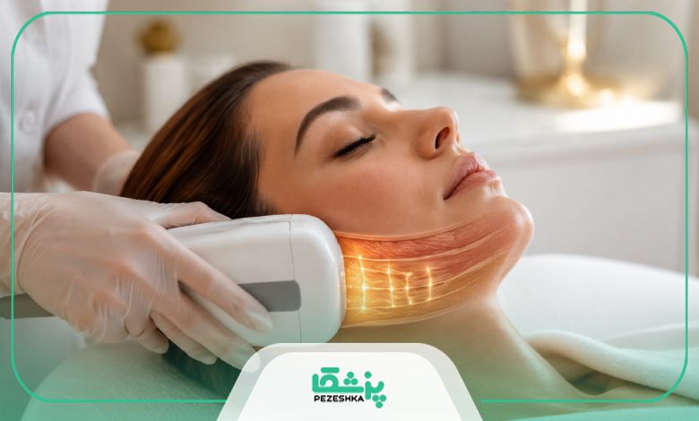 انواع مختلف دستگاه های هایفوتراپی