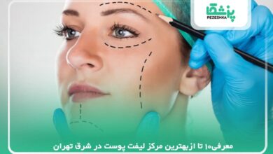 معرفی10 تا ازبهترین مرکز لیفت پوست در شرق تهران【سال1405】❤️