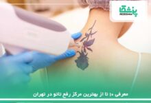 معرفی 10 تا از بهترین مرکز رفع تاتو در تهران【سال1405】❤️