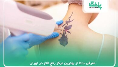 معرفی 10 تا از بهترین مرکز رفع تاتو در تهران【سال1405】❤️