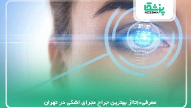 معرفی10تااز بهترین جراح مجرای اشکی در تهران【سال1405 】❤️