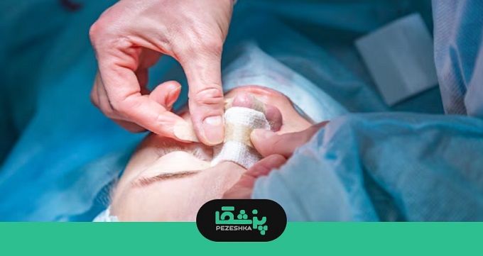 مراقبت های بعد از جراحی بینی