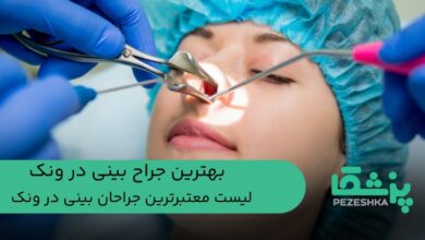 بهترین جراح بینی در ونک