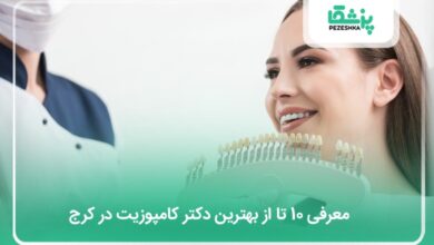 بهترین دکتر کامپوزیت در کرج