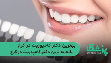 بهترین دکتر کامپوزیت در کرج