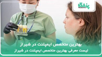 بهترین متخصص ایمپلنت در شیراز