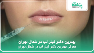 بهترین دکتر فیلر لب در شمال تهران