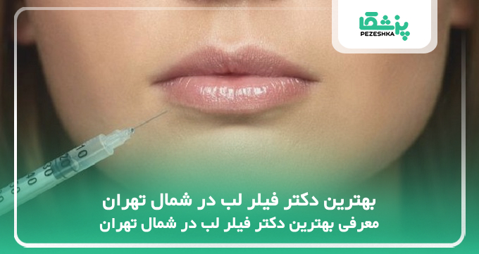 بهترین دکتر فیلر لب در شمال تهران