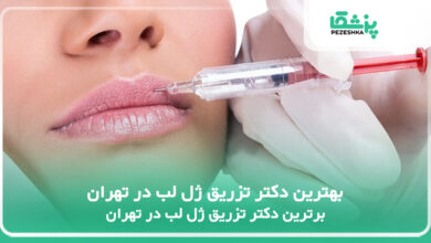 بهترین دکتر تزریق ژل لب در تهران