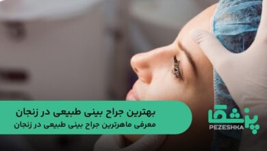 بهترین جراح بینی طبیعی در زنجان