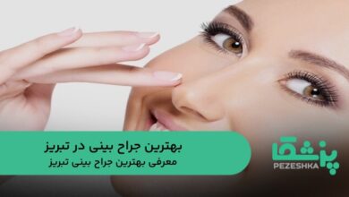 بهترین جراح بینی در تبریز