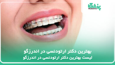 بهترین دکتر ارتودنسی در اندرزگو