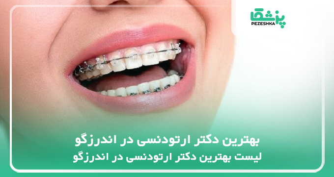 بهترین دکتر ارتودنسی در اندرزگو