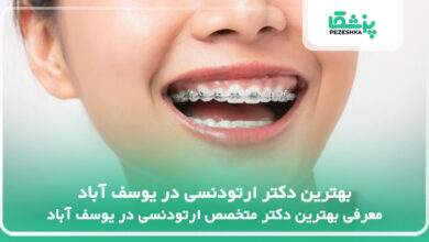 بهترین دکتر ارتودنسی در یوسف آباد