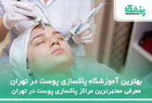 بهترین آموزشگاه پاکسازی پوست در تهران