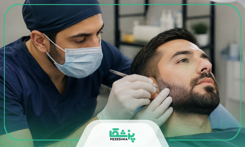 عوارض احتمالی کاشت ریش چیست؟