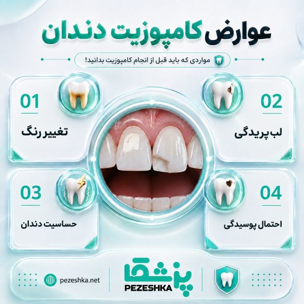چگونه بهترین دکتر کامپوزیت در کرمانشاه را انتخاب کنیم؟