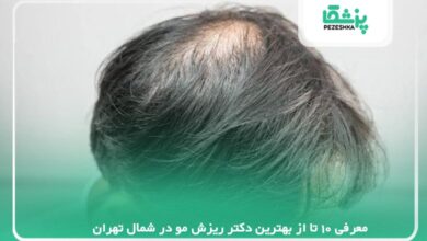 معرفی 10 تا از بهترین دکتر ریزش مو در شمال تهران【سال1405】❤️
