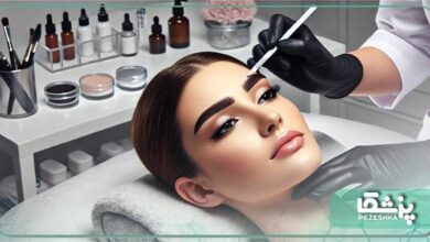 بهترین دکتر کاشت ابرو در یوسف آباد