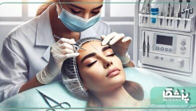 بهترین دکتر کاشت ابرو در زنجان