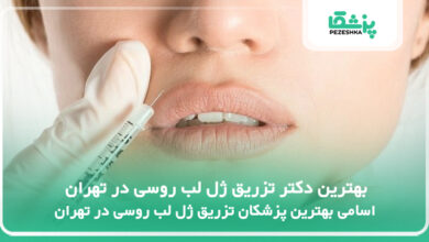 بهترین دکتر تزریق ژل لب روسی در تهران
