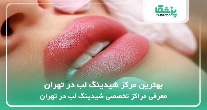 بهترین مرکز شیدینگ لب در تهران