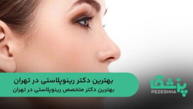 بهترین دکتر رینوپلاستی در تهران