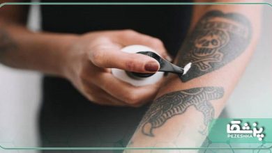 بهترین مرکز پاک کردن تاتو در سعادت آباد