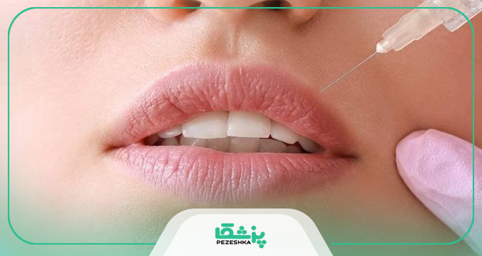 مراقبت های قبل از تزریق ژل لب