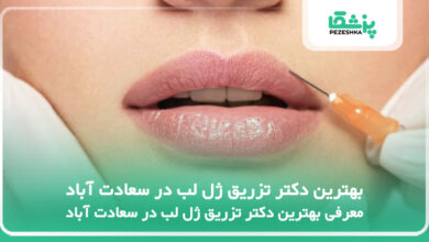 بهترین دکتر تزریق ژل لب در سعادت آباد