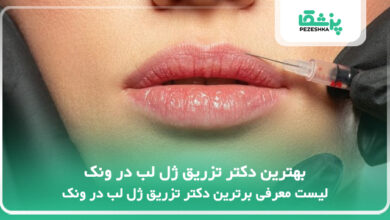 بهترین دکتر تزریق ژل لب در ونک