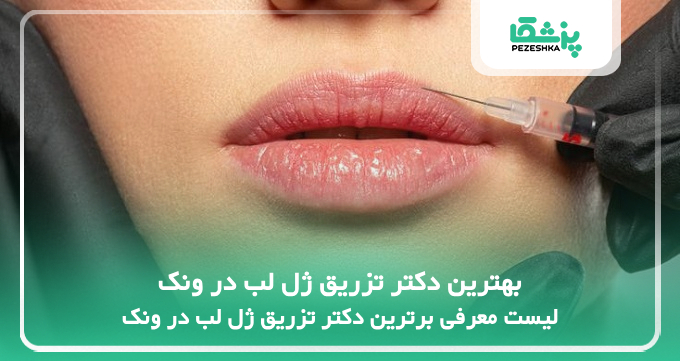 بهترین دکتر تزریق ژل لب در ونک